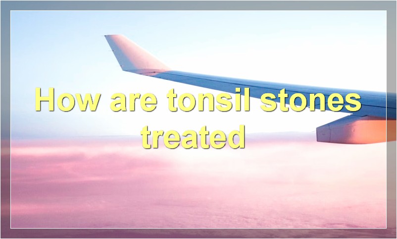 How are tonsil stones treated?