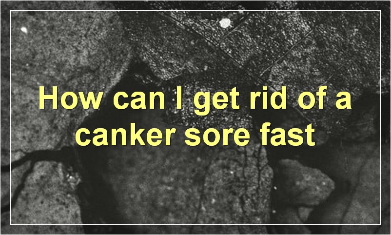 How to Get Rid of a Canker Sore in 25 Hours?