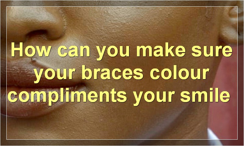 How can you make sure your braces colour compliments your smile?