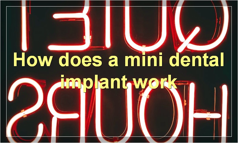 How does a mini dental implant work?