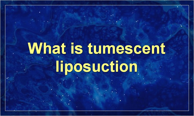 How Much Does Liposuction Cost?